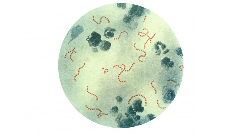 Streptococcus_pyogenes_01