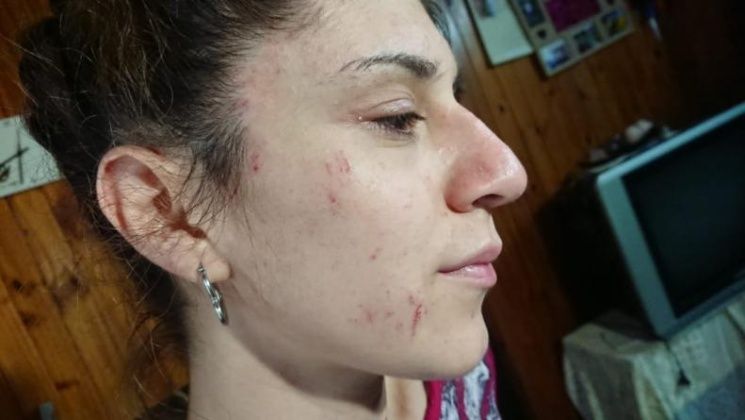 nadia_muller_x1x.jpg_345970201 venganza