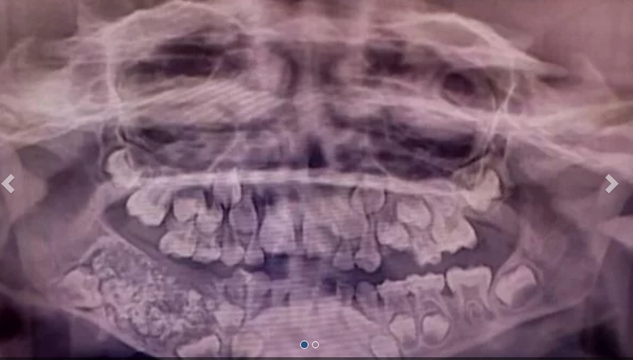 dientes