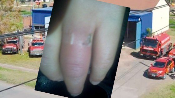 anillo