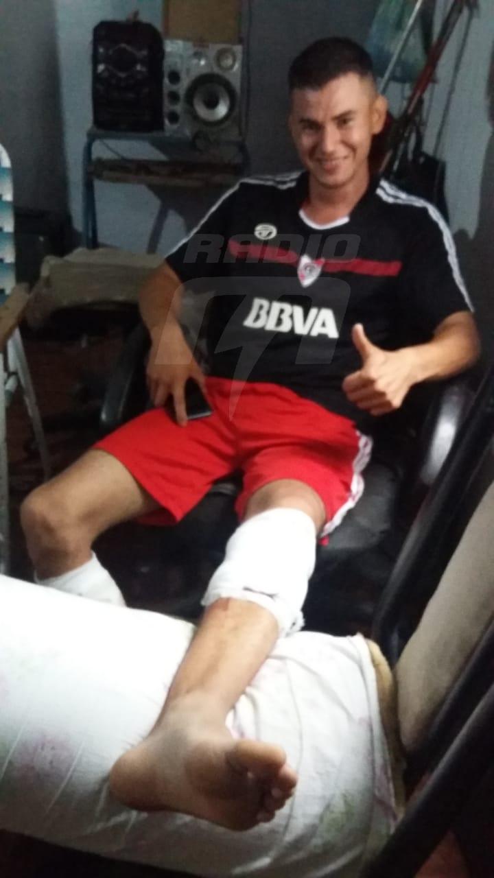 baleado