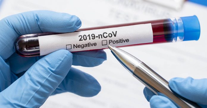 Coronavirus