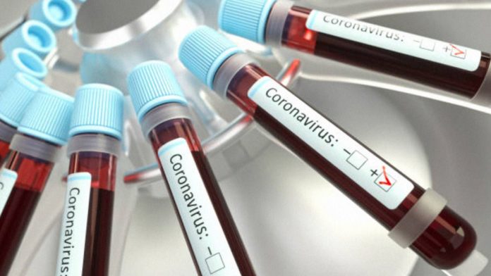 Coronavirus