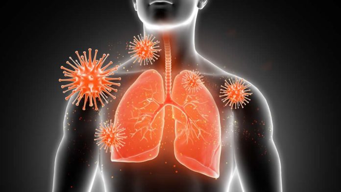 inteligencia-artificial-para-aumentar-el-analisis-de-imagen-pulmonar-en-pacientes-con-covid-19-foto-freepik_15_1000x564