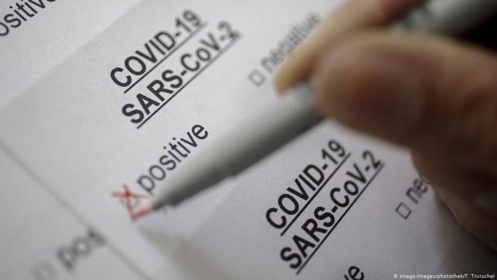 Covid - Informe web
