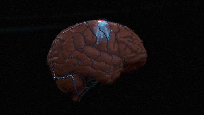 SYN003_1080