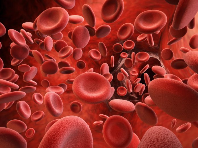 HemochromatosisandHemophilia_share