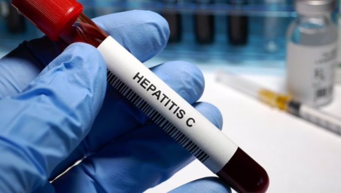 Hepatitis-C