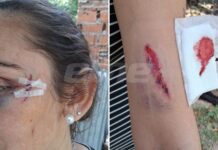 Ataque a balazos en San José del Rincón: hirieron a la hermana del intendente