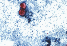 Reportan las primeras dos muertes por brote de ciclosporiasis en Estados Unidos: de qué se trata